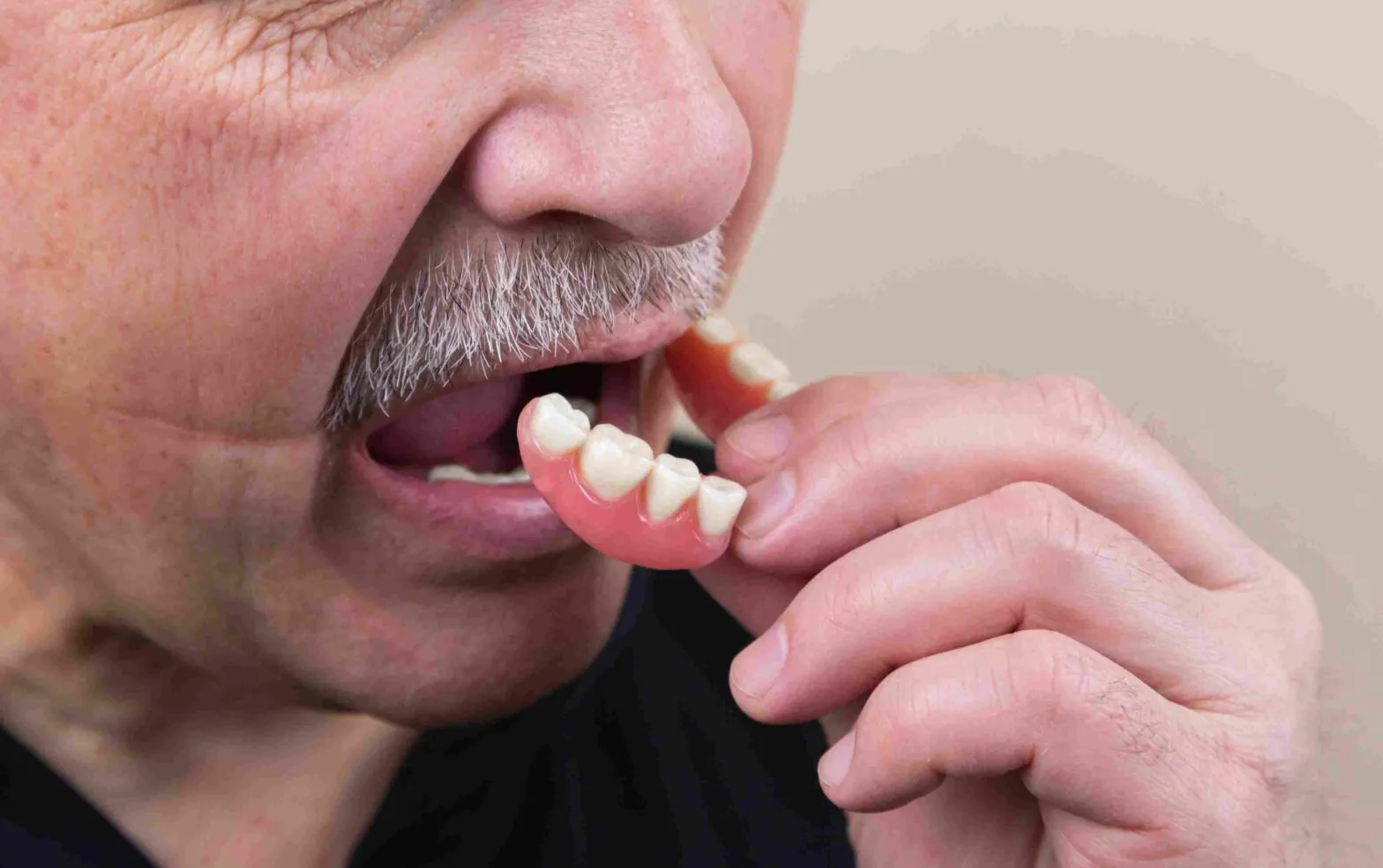 Everything You Need to Know After Getting Dentures | Klinik Gigi Near Me