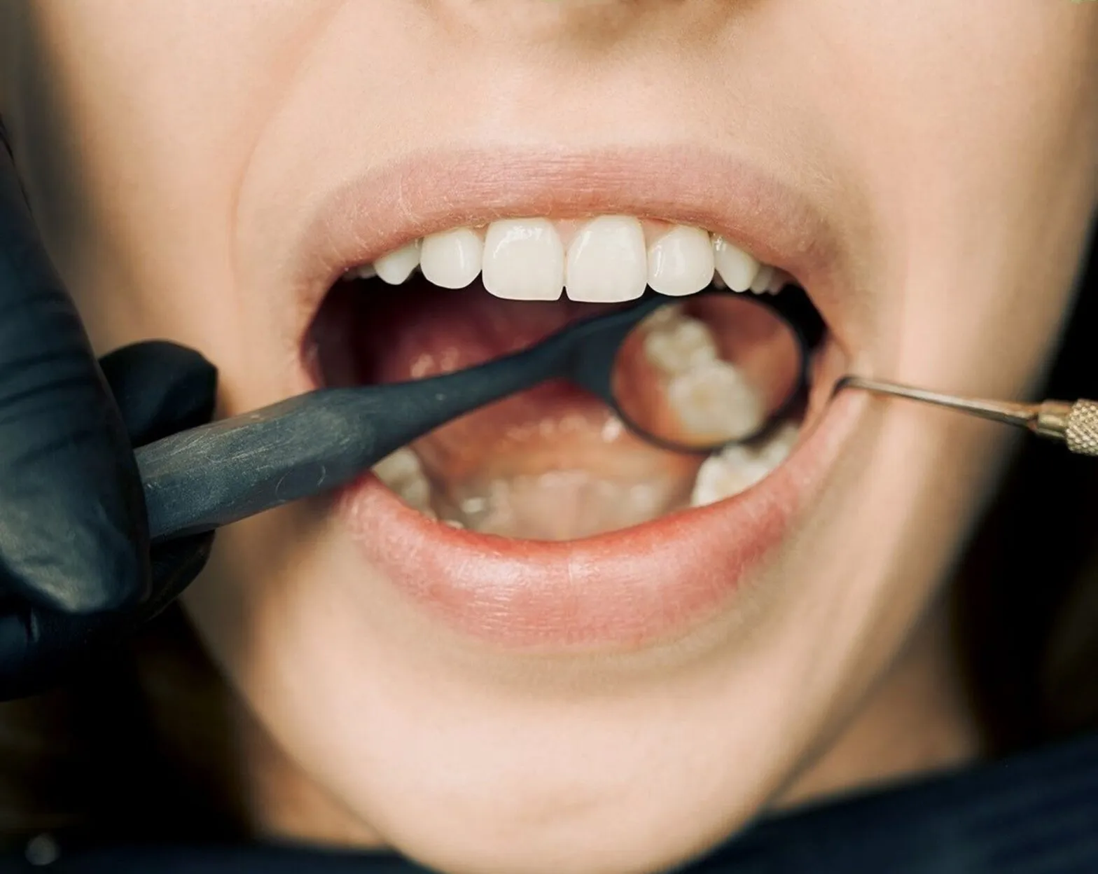 Are You Always Getting Food Stuck In Your Teeth