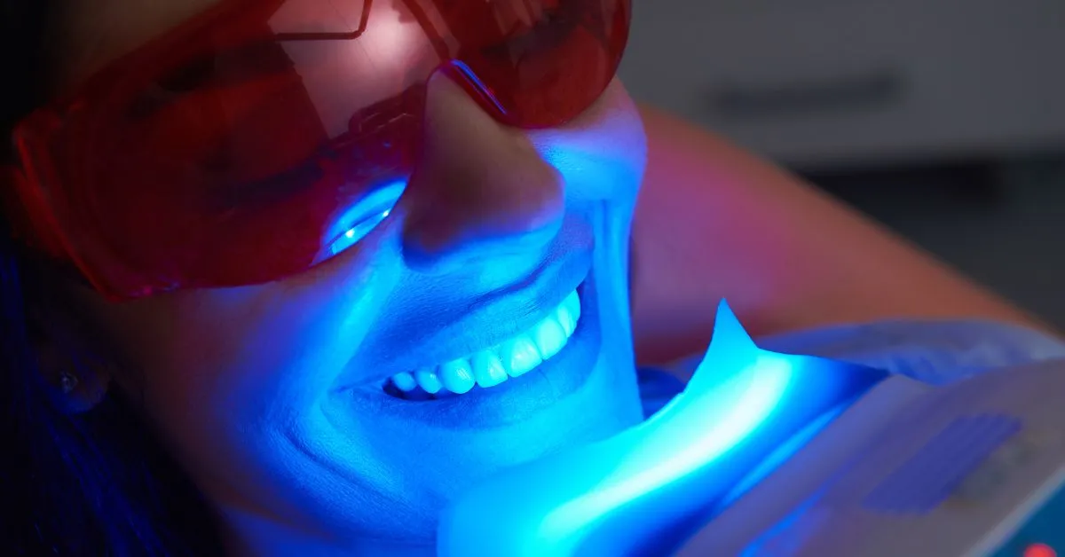Teeth Whitening Price Malaysia_ Comparison of Different Methods