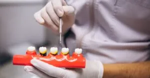 Can Teeth Whitening Gel Be Used on Veneers or Crowns