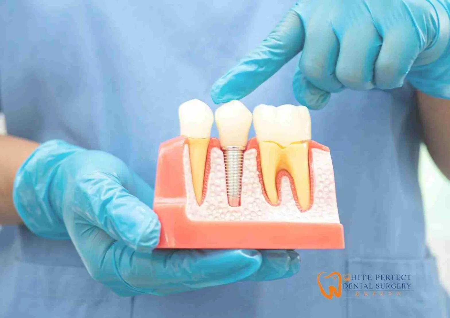 root canal treatment cost