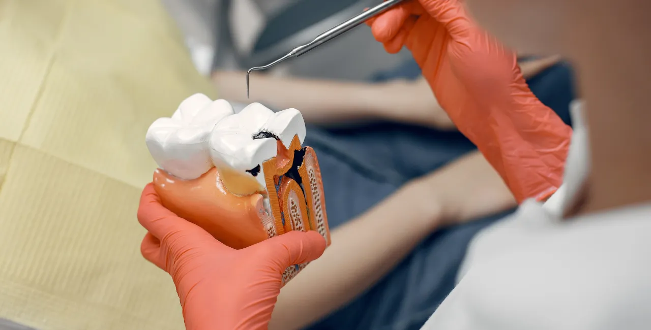 root canal treatment cost