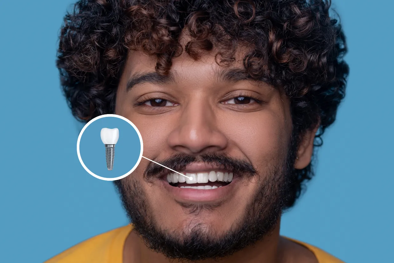 implant tooth cost in malaysia