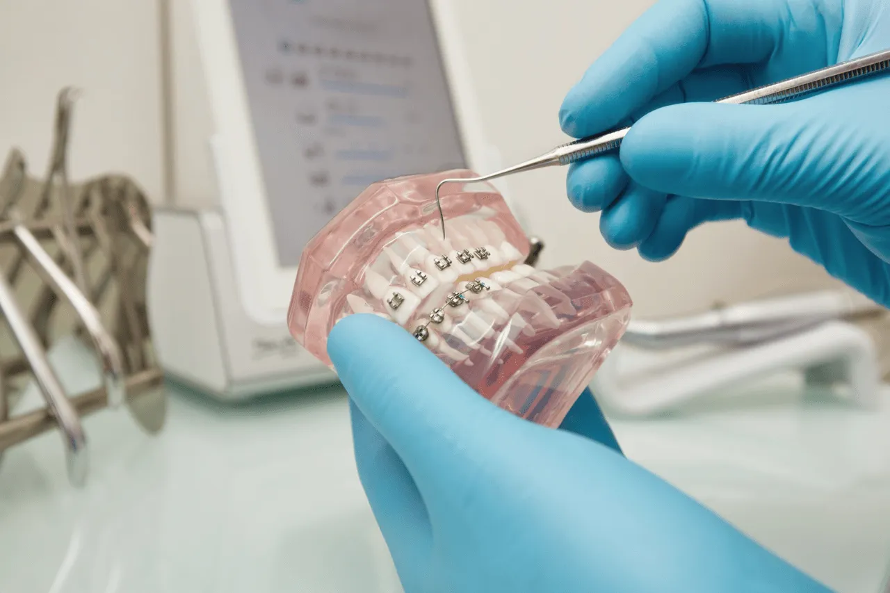 invisalign braces