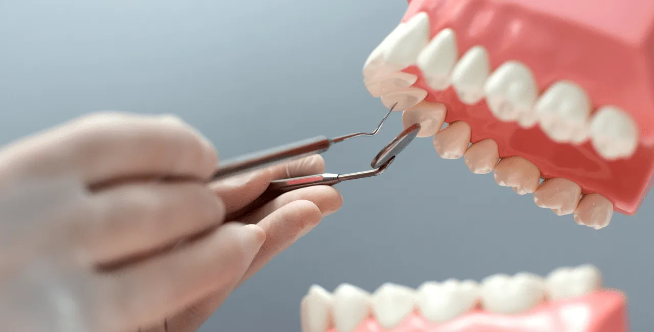 implant tooth cost in malaysia