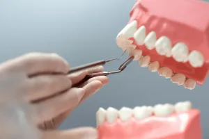 implant tooth cost in malaysia