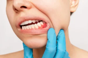 person having gum disease