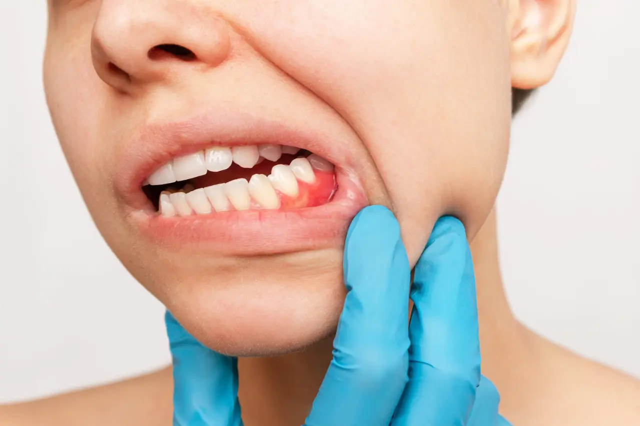 person having gum disease