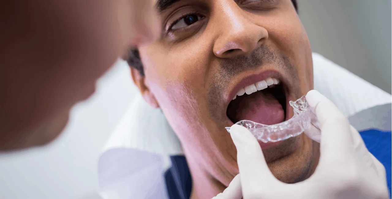 man putting on retainers