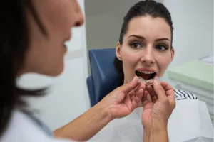 woman with invisible braces