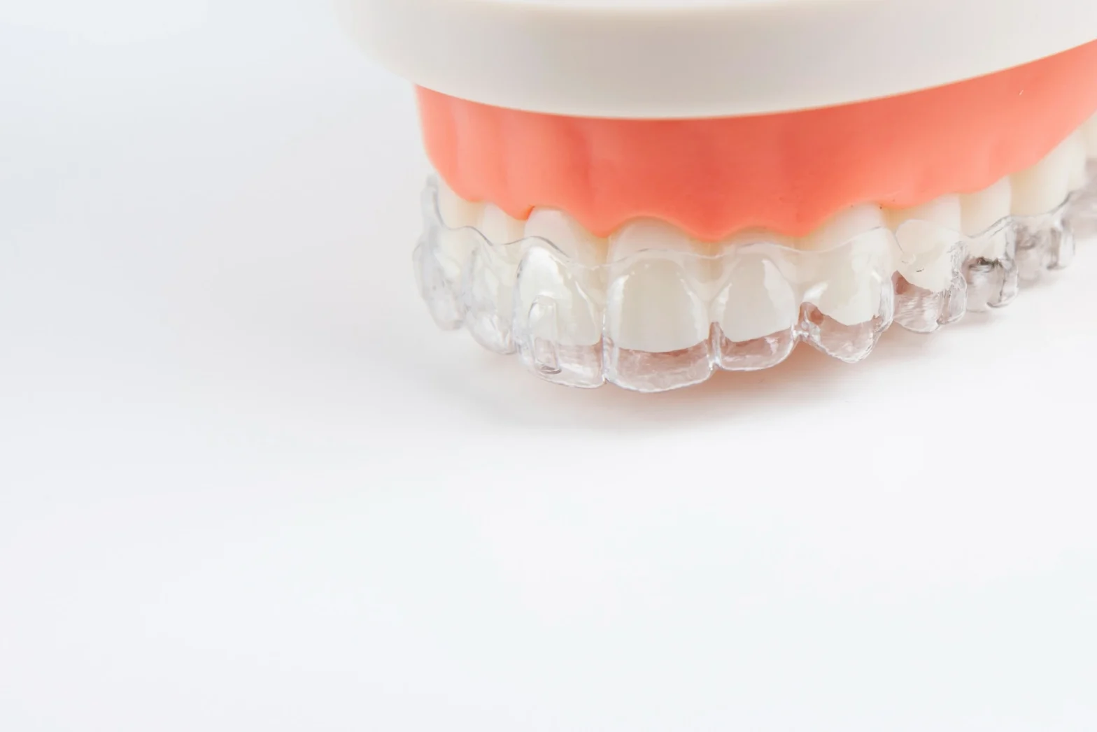 retainer white perfect dental