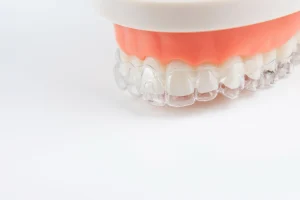 retainer white perfect dental