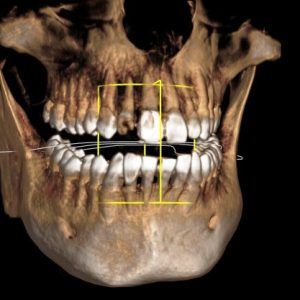 New image for CBCT